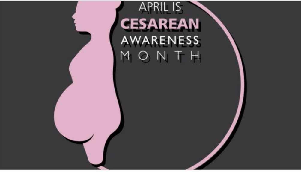 The realities of childbirth today…Cesarean (C-section) Awareness Month 